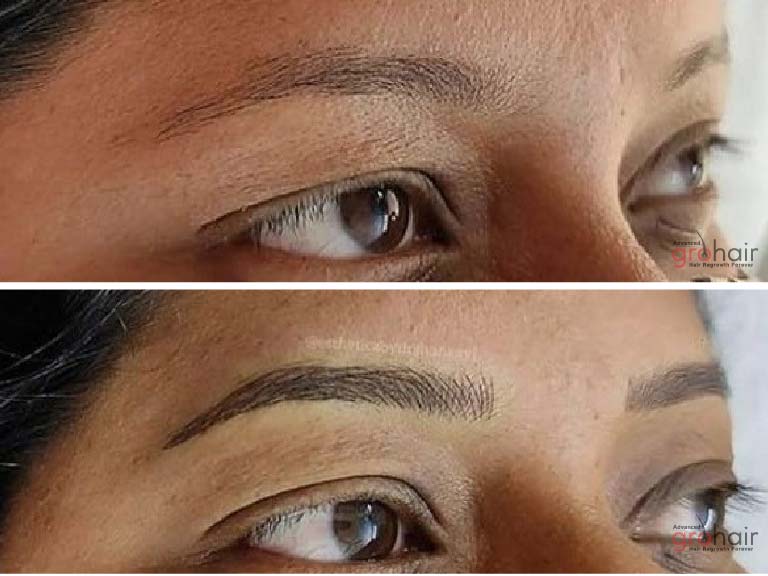 eyebrow growth sholinganallur