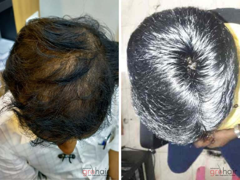 hair growth clinic