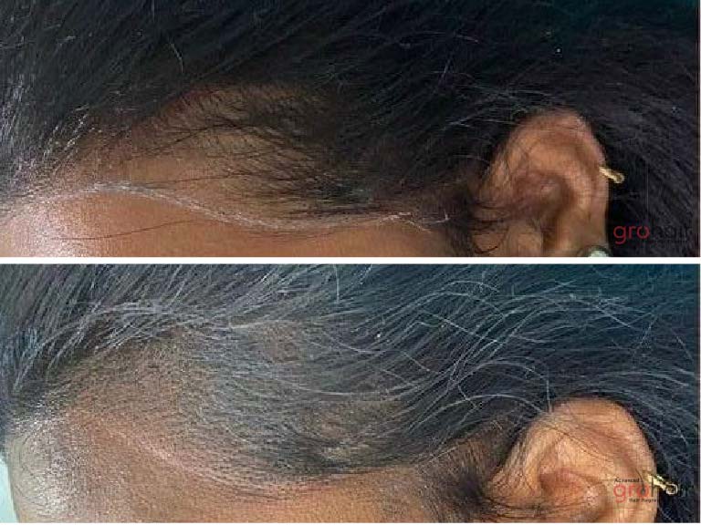 hair loss clinic